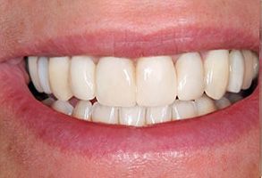 Dental Wellness Center of Florida