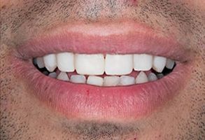 Dental Wellness Center of Florida