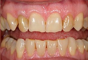 Dental Wellness Center of Florida