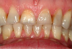 Dental Wellness Center of Florida